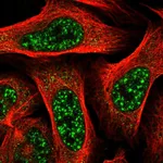 Atlas Antibodies Anti-TBC1D8 Antibody