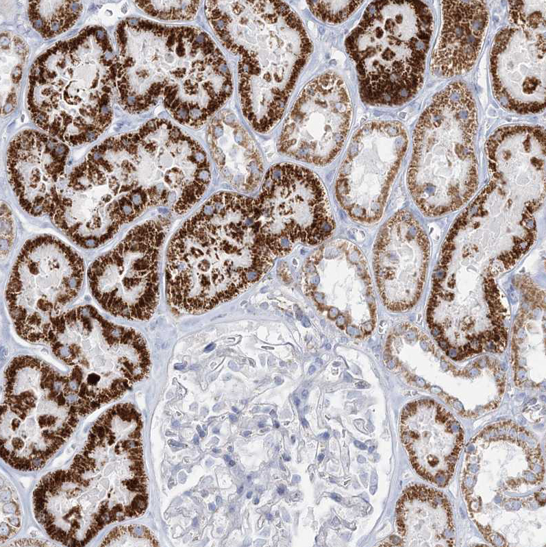 Atlas Antibodies Anti-TBC1D7 Antibody