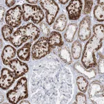 Atlas Antibodies Anti-TBC1D7 Antibody
