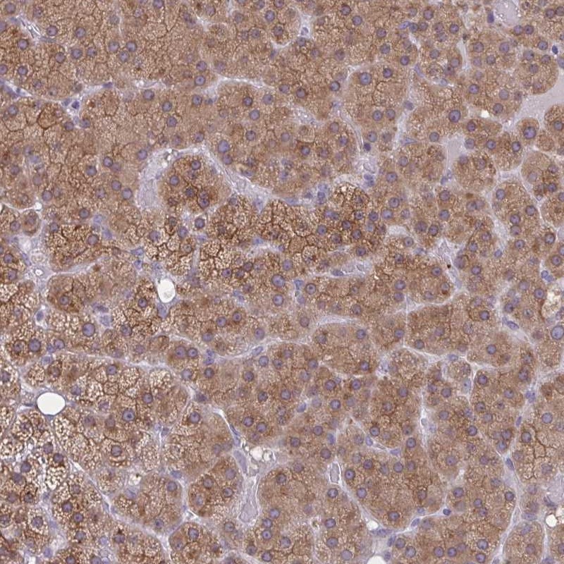 Atlas Antibodies Anti-TBC1D4 Antibody