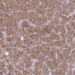 Atlas Antibodies Anti-TBC1D4 Antibody