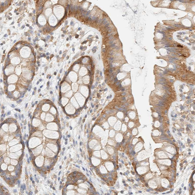 Atlas Antibodies Anti-TBC1D8B Antibody