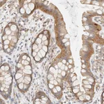 Atlas Antibodies Anti-TBC1D8B Antibody
