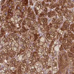 Atlas Antibodies Anti-TBC1D4 Antibody