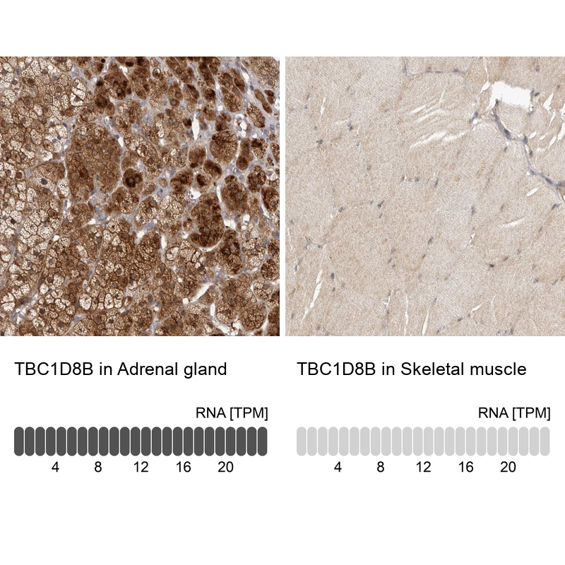 Atlas Antibodies Anti-TBC1D8B Antibody
