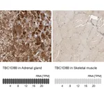 Atlas Antibodies Anti-TBC1D8B Antibody