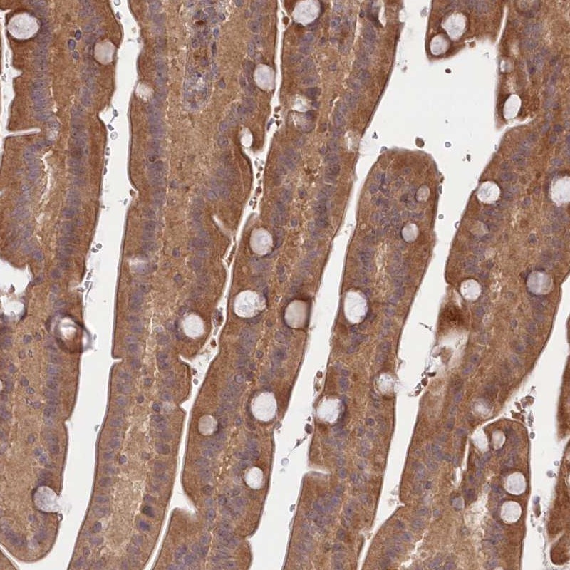 Atlas Antibodies Anti-TBCA Antibody