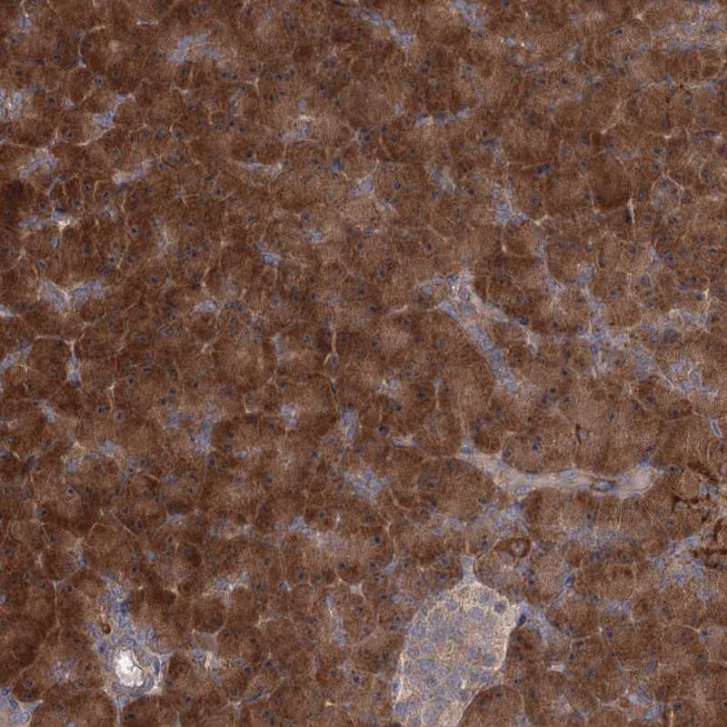 Atlas Antibodies Anti-TBC1D9B Antibody