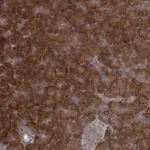 Atlas Antibodies Anti-TBC1D9B Antibody