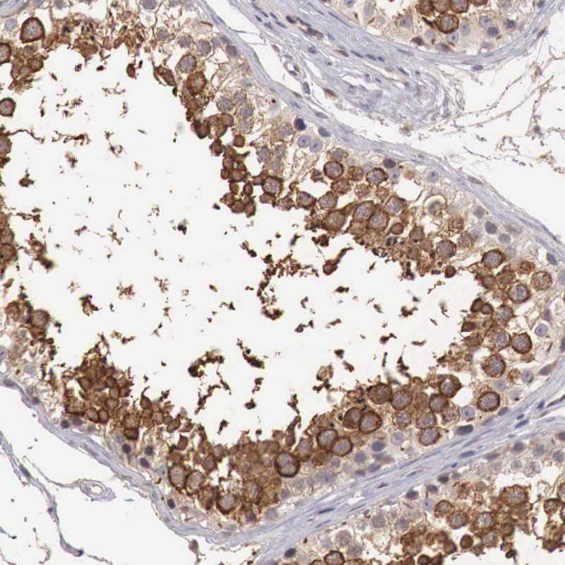 Atlas Antibodies Anti-TBC1D9 Antibody