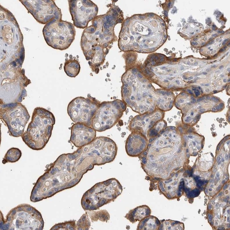 Atlas Antibodies Anti-TBCE Antibody