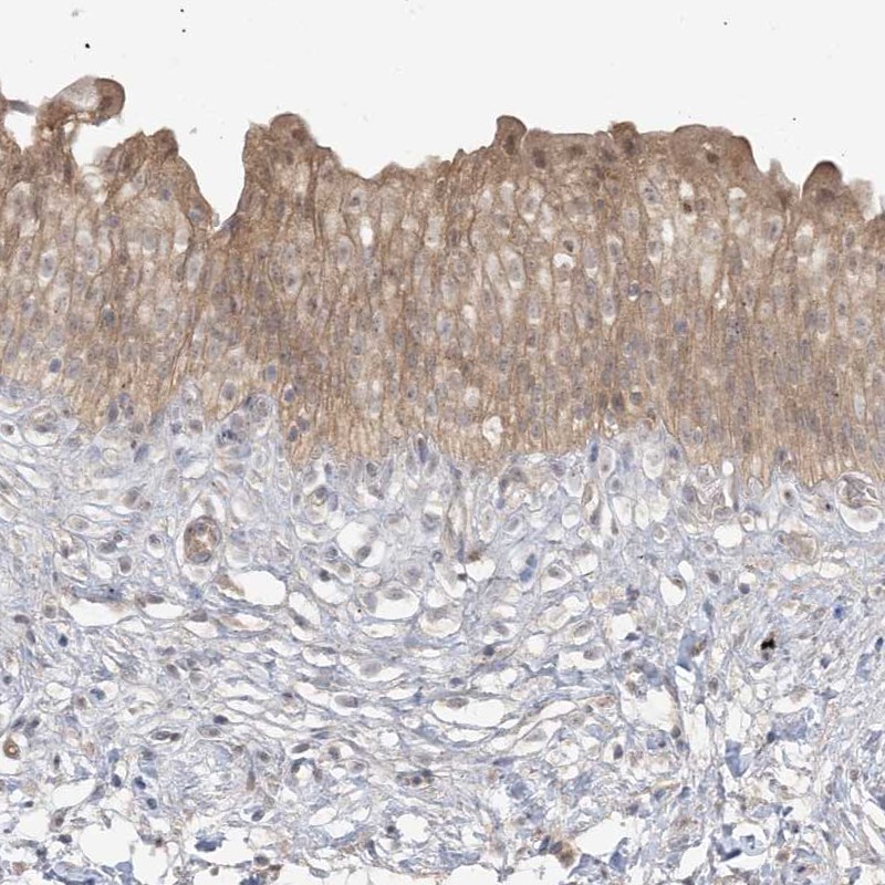 Atlas Antibodies Anti-TBCC Antibody