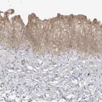 Atlas Antibodies Anti-TBCC Antibody