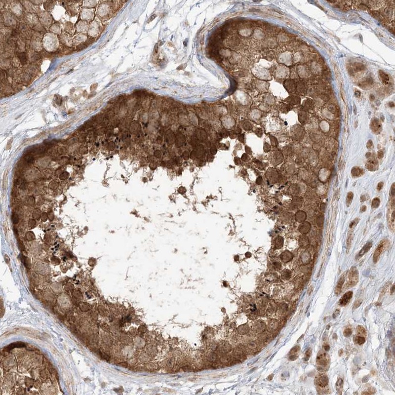 Atlas Antibodies Anti-TBCC Antibody