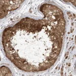 Atlas Antibodies Anti-TBCC Antibody
