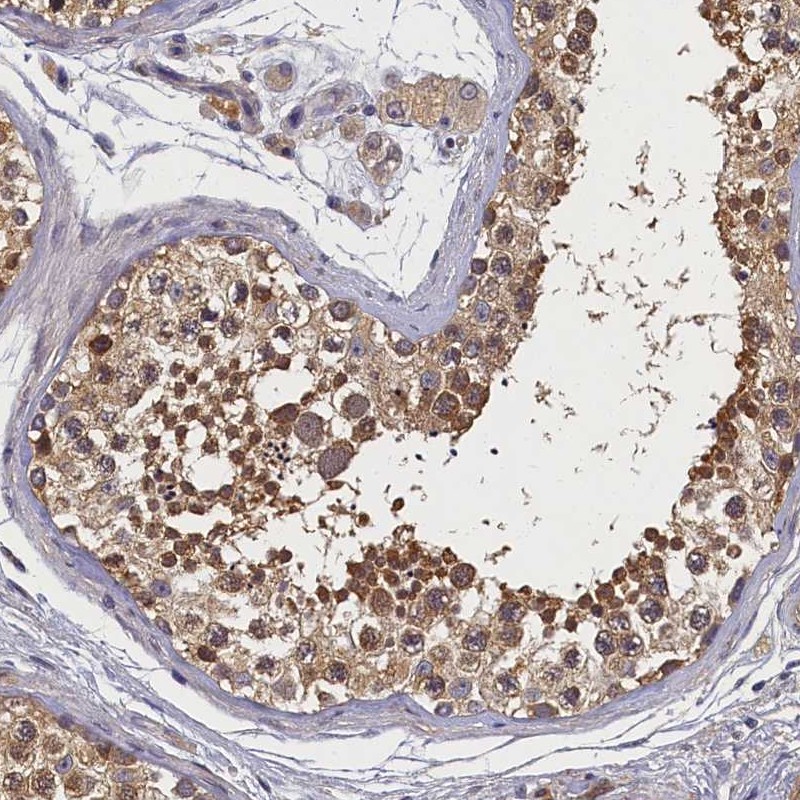 Atlas Antibodies Anti-TBCB Antibody