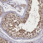 Atlas Antibodies Anti-TBCB Antibody