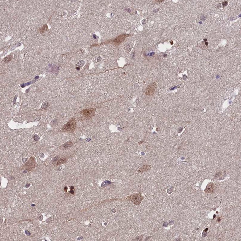 Atlas Antibodies Anti-TBCB Antibody