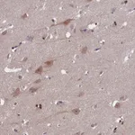 Atlas Antibodies Anti-TBCB Antibody