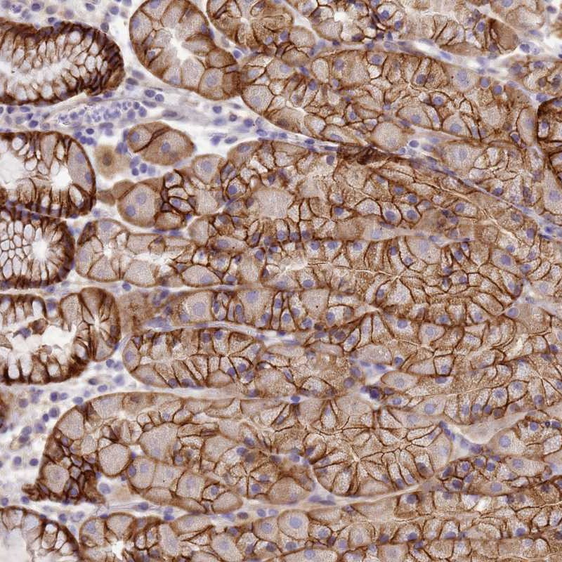 Atlas Antibodies Anti-TBCD Antibody