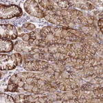 Atlas Antibodies Anti-TBCD Antibody