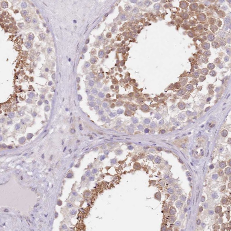 Atlas Antibodies Anti-TBC1D9 Antibody