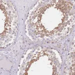 Atlas Antibodies Anti-TBC1D9 Antibody