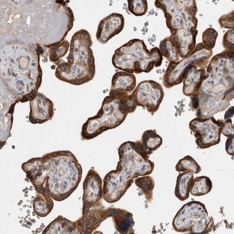 Atlas Antibodies Anti-TBCE Antibody
