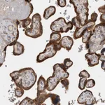 Atlas Antibodies Anti-TBCE Antibody