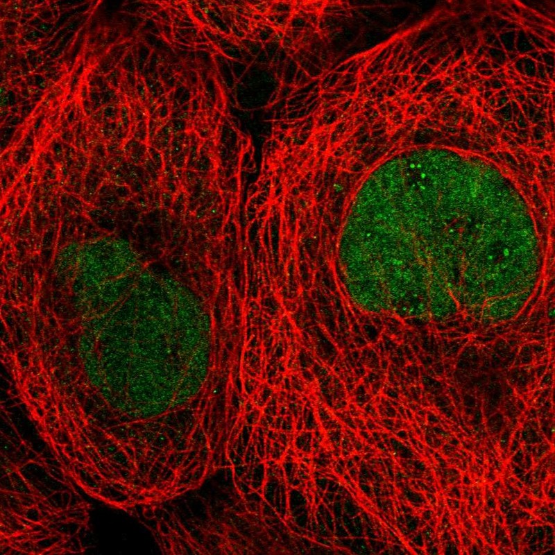 Atlas Antibodies Anti-TBCK Antibody