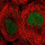 Atlas Antibodies Anti-TBCK Antibody
