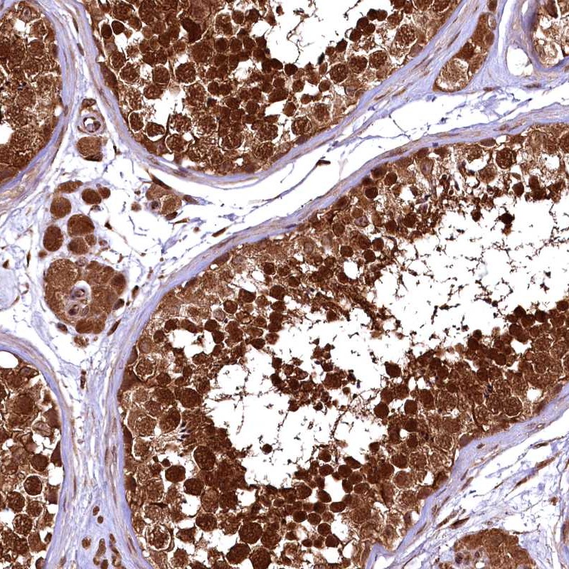 Atlas Antibodies Anti-TBCEL Antibody