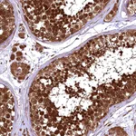 Atlas Antibodies Anti-TBCEL Antibody