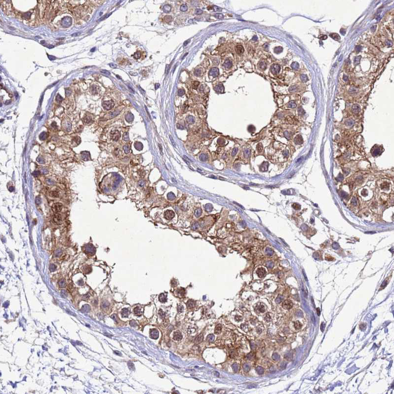Atlas Antibodies Anti-TBK1 Antibody
