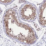 Atlas Antibodies Anti-TBK1 Antibody