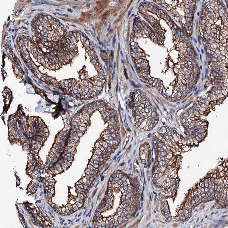 Atlas Antibodies Anti-TBCEL Antibody