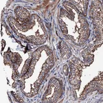 Atlas Antibodies Anti-TBCEL Antibody