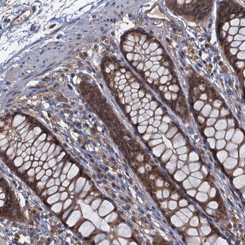 Atlas Antibodies Anti-TBCK Antibody