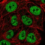 Atlas Antibodies Anti-TBK1 Antibody