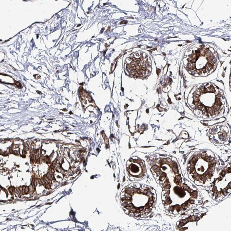 Atlas Antibodies Anti-TBKBP1 Antibody