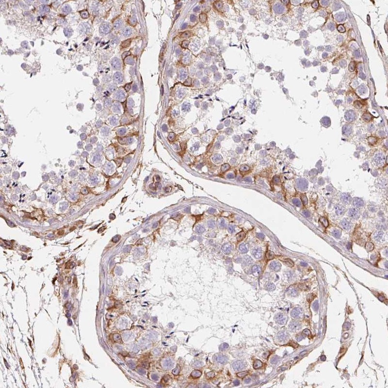 Atlas Antibodies Anti-TBKBP1 Antibody
