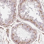 Atlas Antibodies Anti-TBKBP1 Antibody