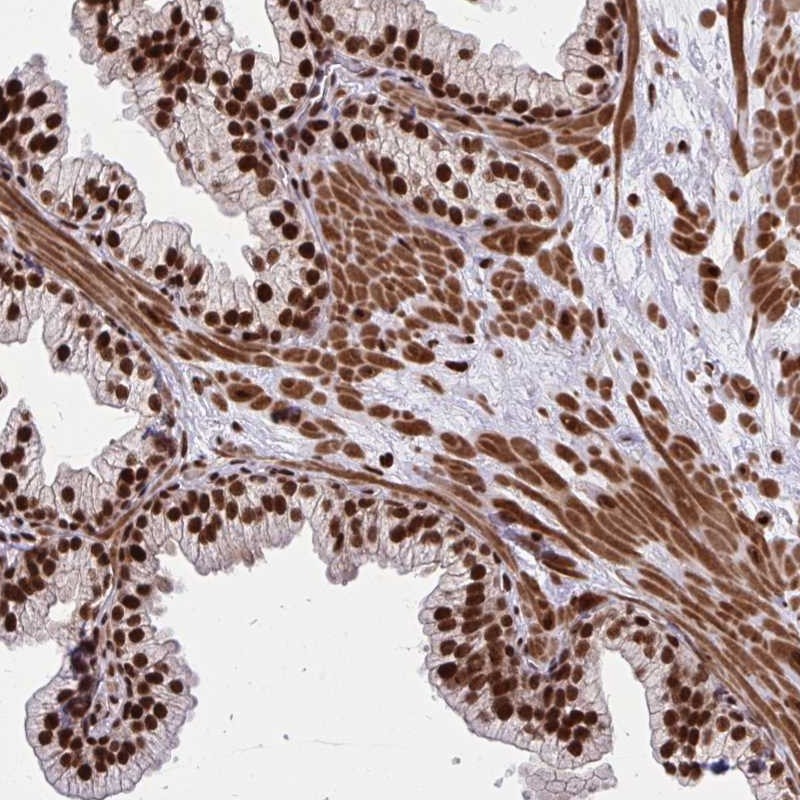 Atlas Antibodies Anti-TBL1Y Antibody