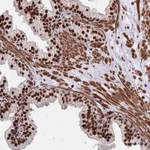 Atlas Antibodies Anti-TBL1Y Antibody