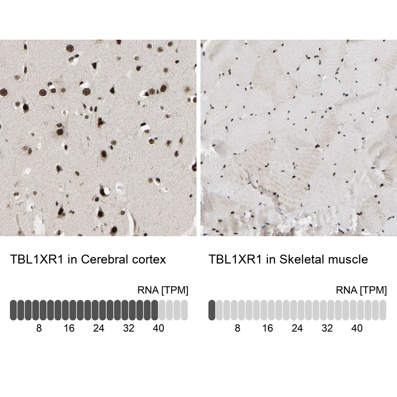 Atlas Antibodies Anti-TBL1XR1 Antibody