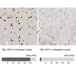Atlas Antibodies Anti-TBL1XR1 Antibody