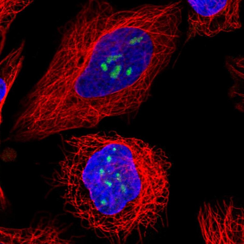 Atlas Antibodies Anti-TBL3 Antibody