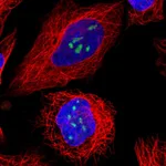 Atlas Antibodies Anti-TBL3 Antibody