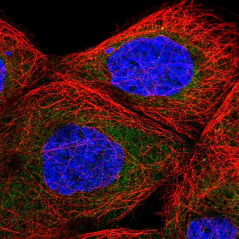 Atlas Antibodies Anti-TBL2 Antibody