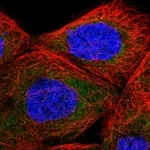 Atlas Antibodies Anti-TBL2 Antibody
